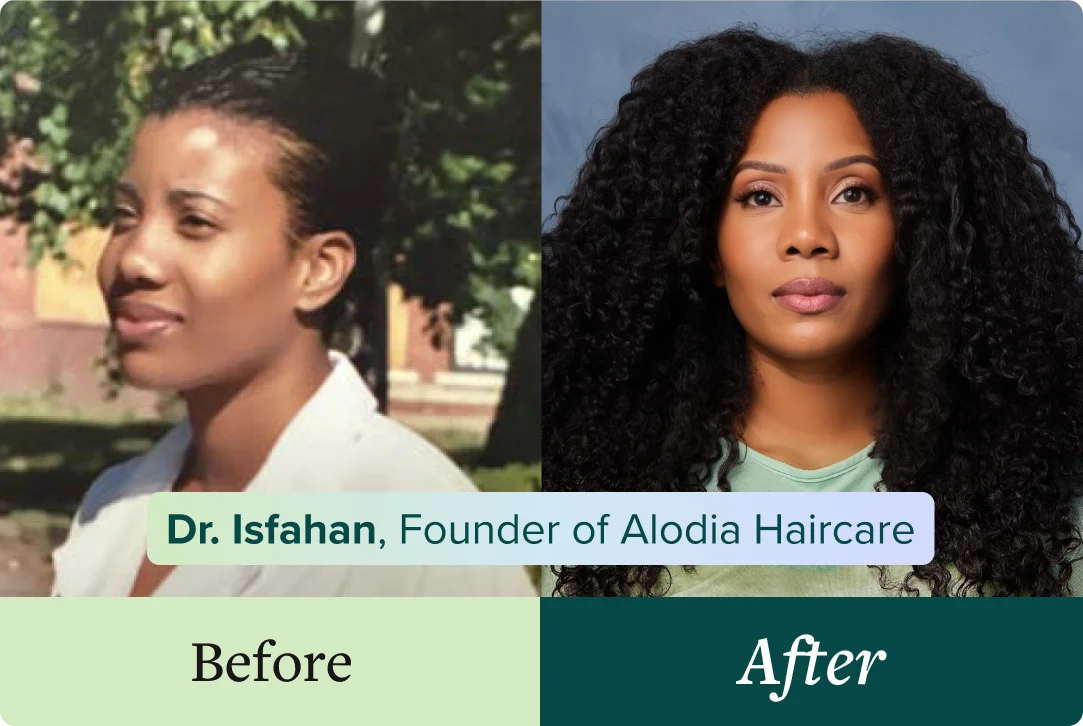 Dr. Isfahan's hair transformation before and after using Alodia products